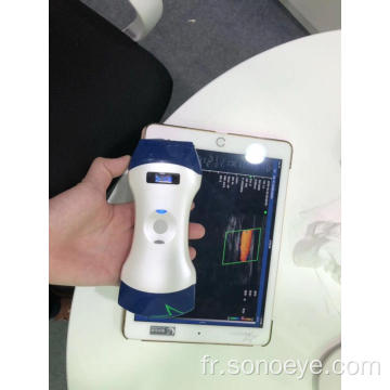 Scanner à ultrasons de la sonde wifi